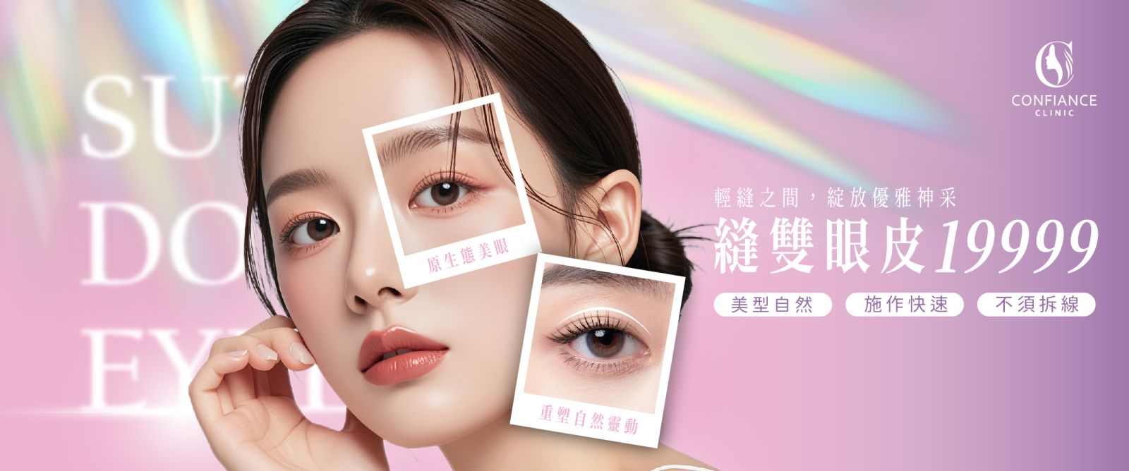 自由風 自然魅力雙眼皮手術